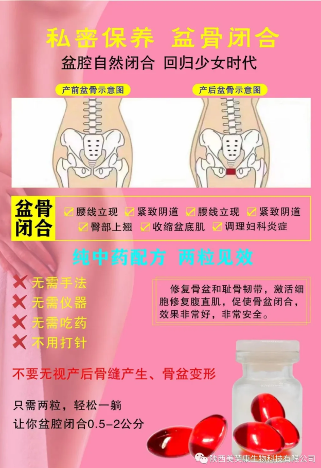 骨盆修復(fù)軟凝膠 骨盆修復(fù)軟凝膠